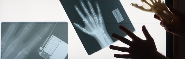 Bannerfoto: Röntgenbilder von einer Hand und anderen Objekten. Biomedizinische Technik (Bachelor)