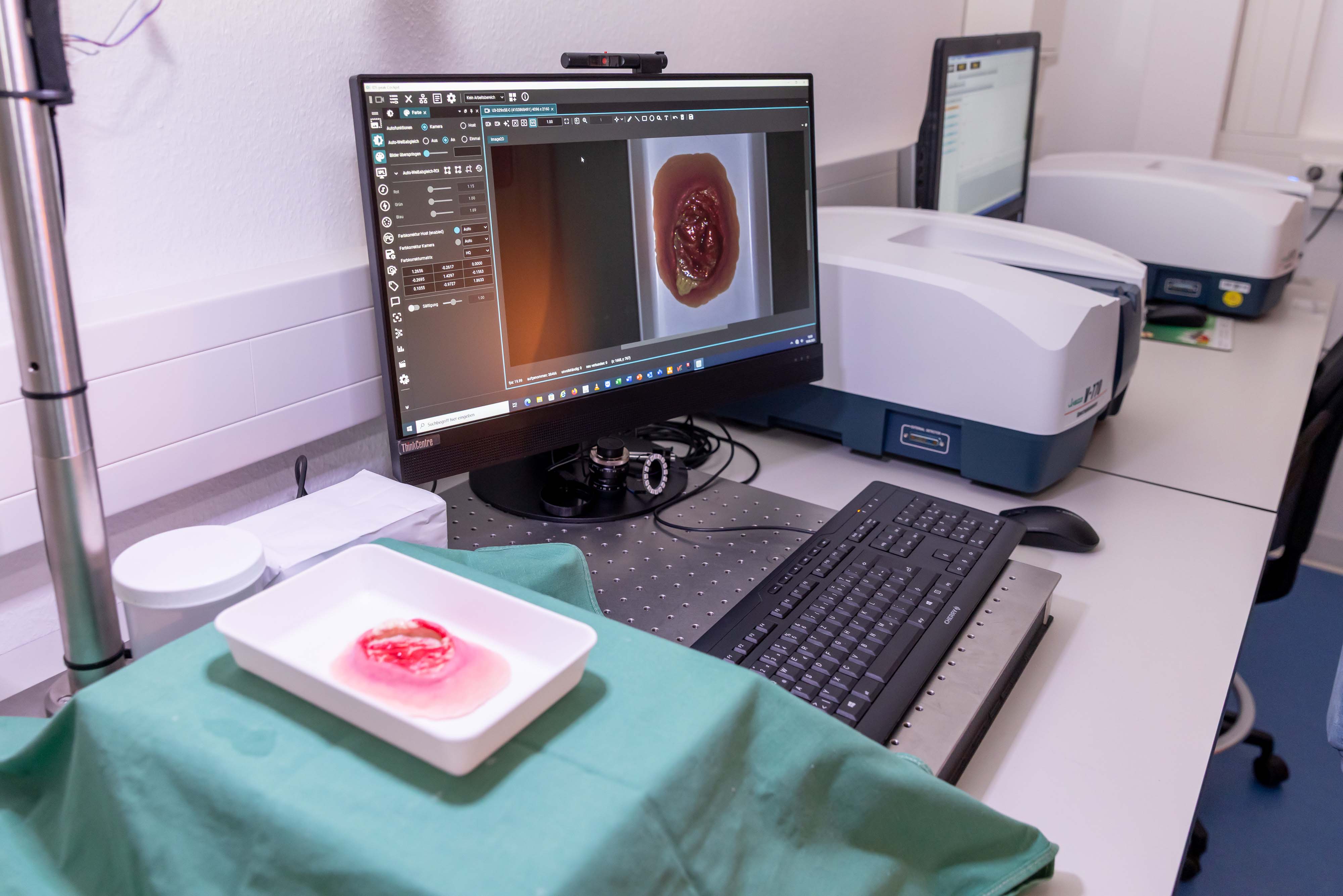 Eine Gewebeprobe liegt vor einem Computer, der Daten anzeigt. 